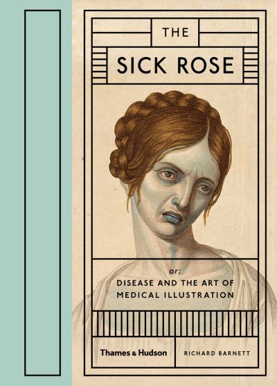 The Sick Rose, Or, Disease and the Art of Medical Illustration