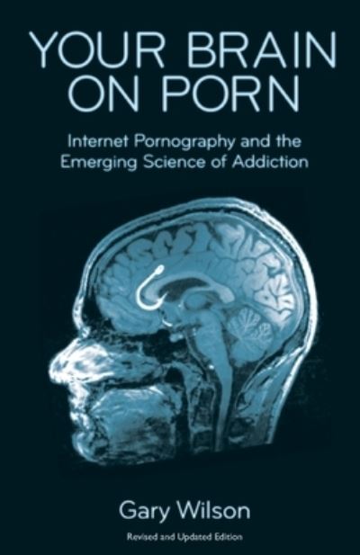 Your brain on porn